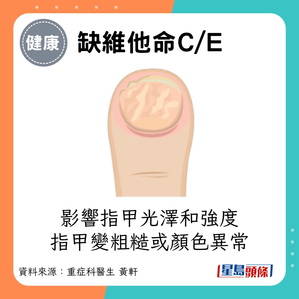 缺维他命C/E：影响指甲的光泽和强度，指甲变粗糙或颜色异常