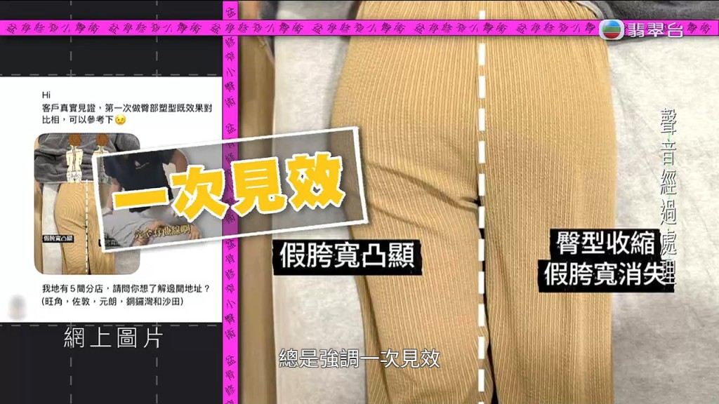 涉事店舖以「一次見效、假胯寬消失」等誇張字眼吸引顧客。 涉事店舖以「一次見效、假胯寬消失」等誇張字眼吸引顧客。