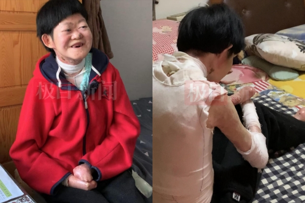 高尚好近照。 極目新聞 高尚好近照。 極目新聞