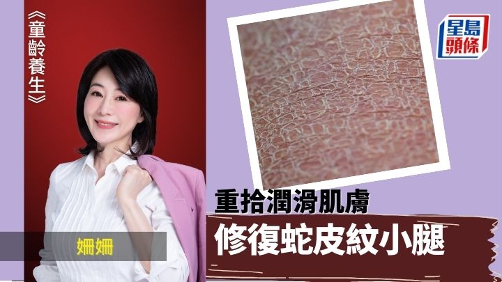 重拾潤滑肌膚 修復蛇皮紋小腿｜童齡養生