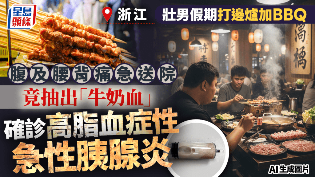 暴飲暴食險死︱浙江壯男火鍋加燒烤   腹痛送院抽出「牛奶血」
