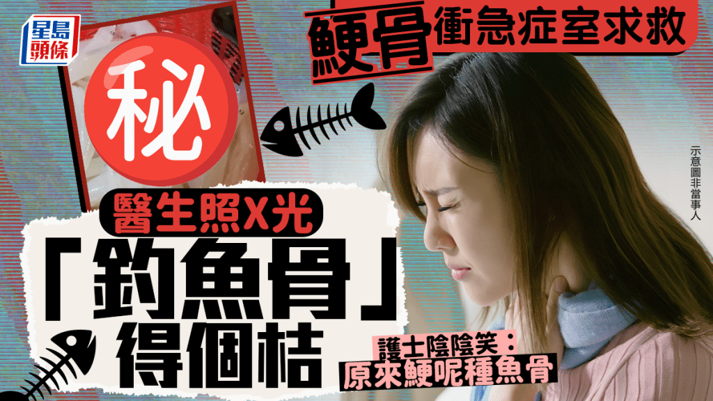 鯁骨衝急症室求救 醫生照X光「釣魚骨」得個桔 護士陰陰笑：原來鯁呢種魚骨