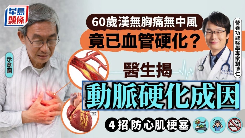 60歲漢無胸痛無中風竟已血管硬化？醫生揭動脈硬化成因 4招防心肌梗塞