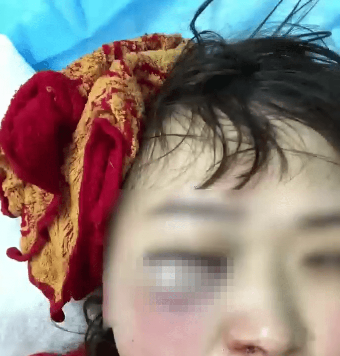 艾女發布被家暴的照片。 艾女發布被家暴的照片。