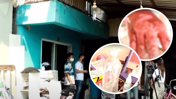 泰國一名女子以酒精噴灑全身消毒後點蚊香導致燒傷，當地政府人員到事發地點調查。網上片段截圖