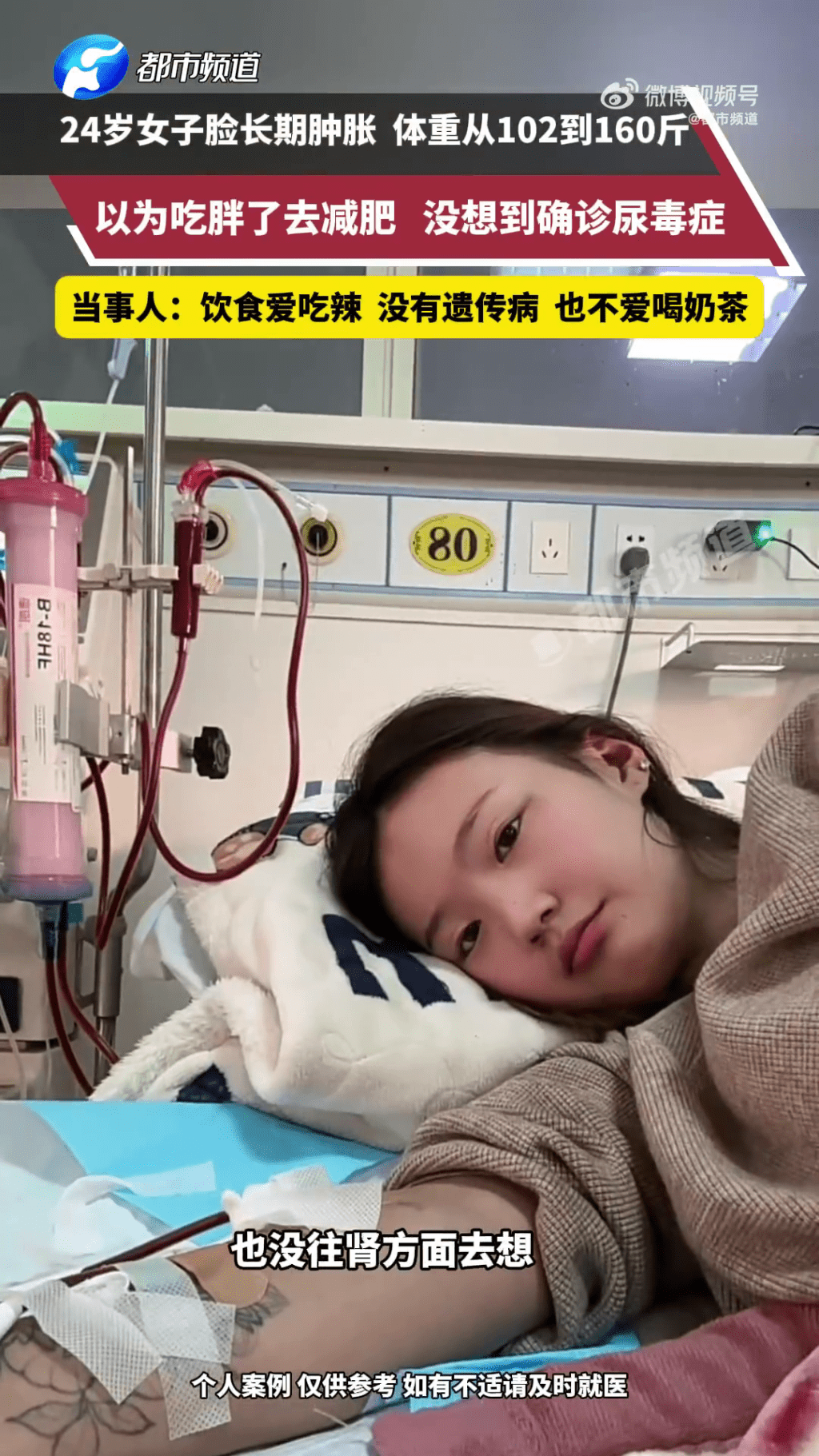 暴增近30kg以為吃多了，女子半年減肥25kg後確診尿毒症。 都市頻道