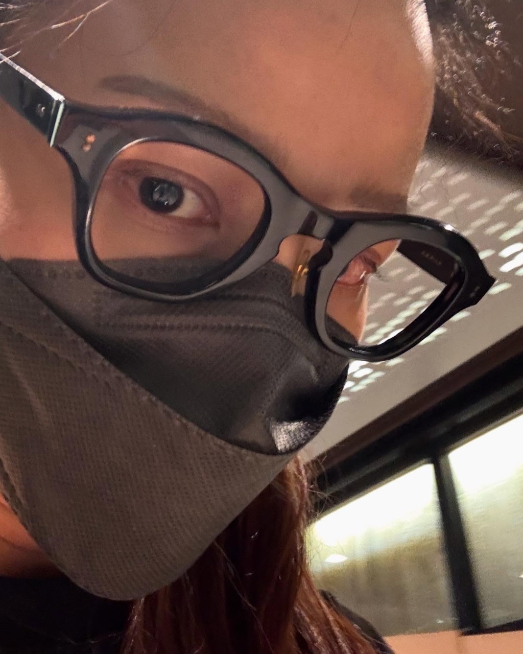 滕麗名驚爆視網膜脫落。 滕麗名驚爆視網膜脫落。