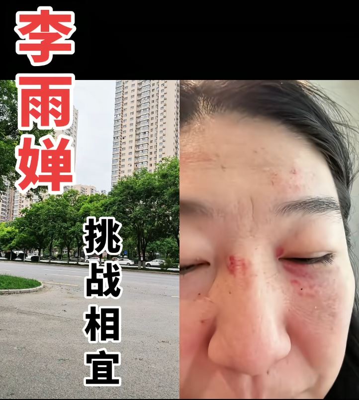 李雨禪到車厘子市集「踩場」與人衝突被打。