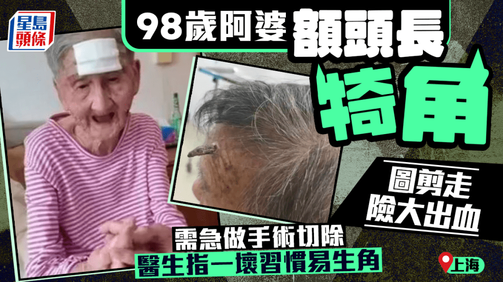 上海98歲阿婆自剪額角險大出血  醫生話一壞習慣易生角