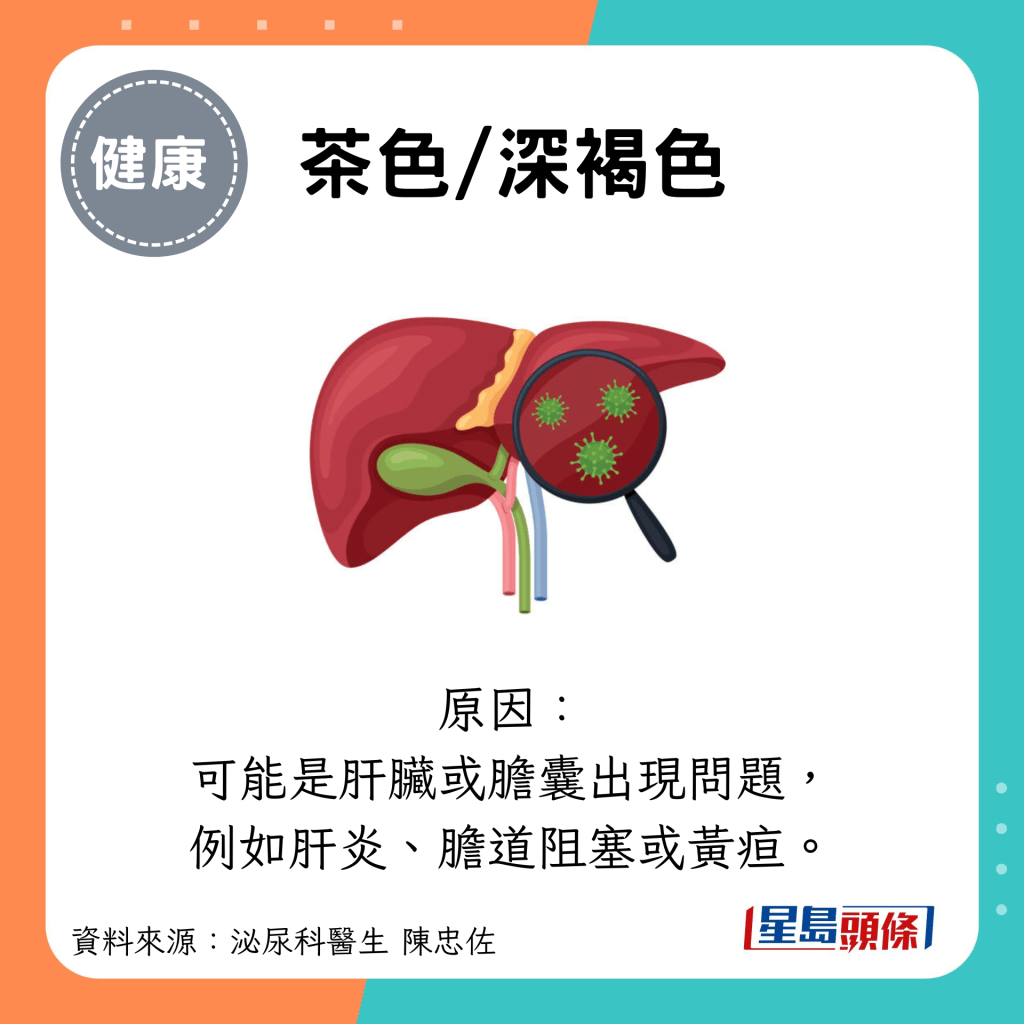 茶色/深褐色：原因： 可能是肝臟或膽囊出現問題， 例如肝炎、膽道阻塞或黃疸。