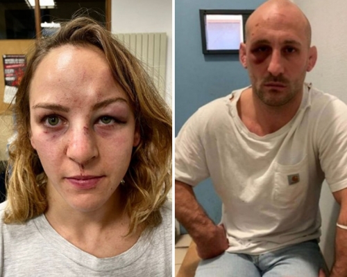 法國金牌柔道女選手自爆遭男友家暴，互相發布受傷照片。網圖