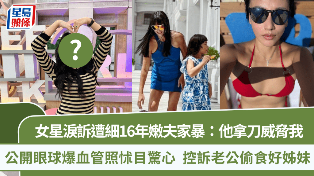 女星淚訴遭細16年嫩夫家暴：他拿刀威脅我  公開眼球爆血管照怵目驚心  控訴老公偷食好姊妹