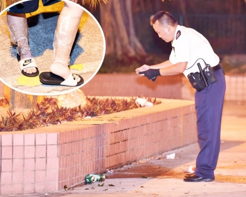 案件交由西區警區重案組第一隊跟進。小圖為腳部受傷的傷者。