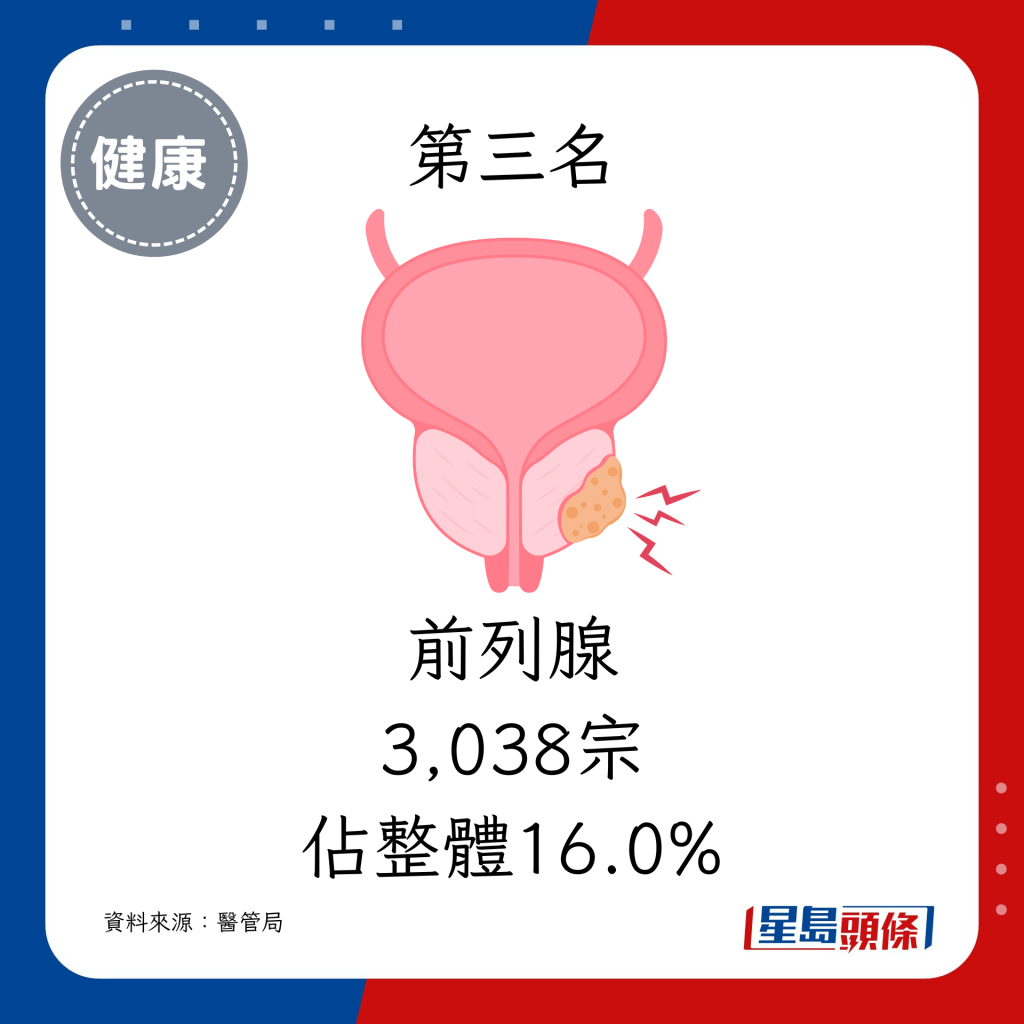 3. 前列腺（3,038宗，佔整體16.0%）