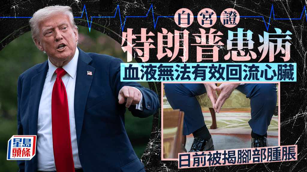 特朗普確診患靜脈疾病，白宮稱情況常見