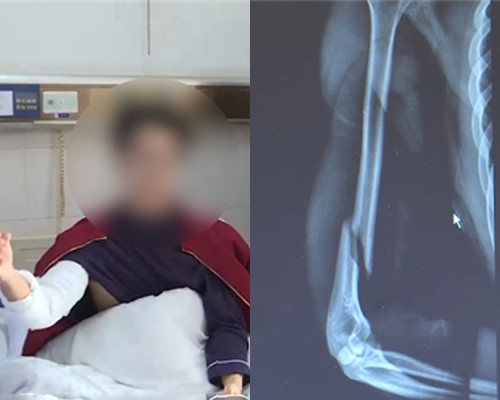 小萧说：「要靠内一点，当时的姿势手比较靠外就伤了。」(网图)