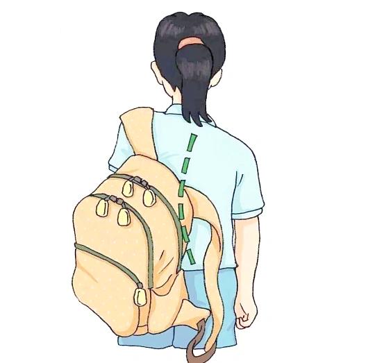 脊柱側彎主要分為結構性和非結構性。圖片由筆者提供