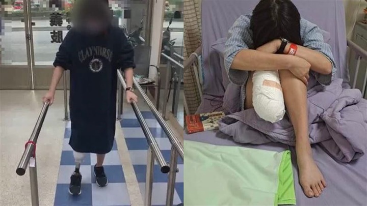 台灣一女包裝工遭遇工業意外須截肢,工廠被判罰款停工。網上圖片