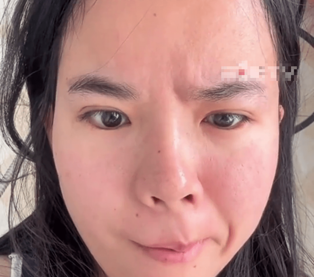 河南年輕美女午睡吹風扇醒來,嘴歪眼斜,喝水吃飯都會不斷從嘴巴漏出來。 河南年輕美女午睡吹風扇醒來,嘴歪眼斜,喝水吃飯都會不斷從嘴巴漏出來。