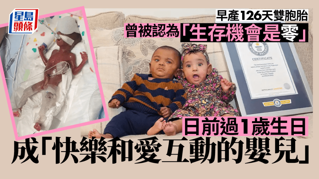 早產126天被認為存活機率零，雙胞胎如今慶1歲生日，創下健力士世界紀錄。