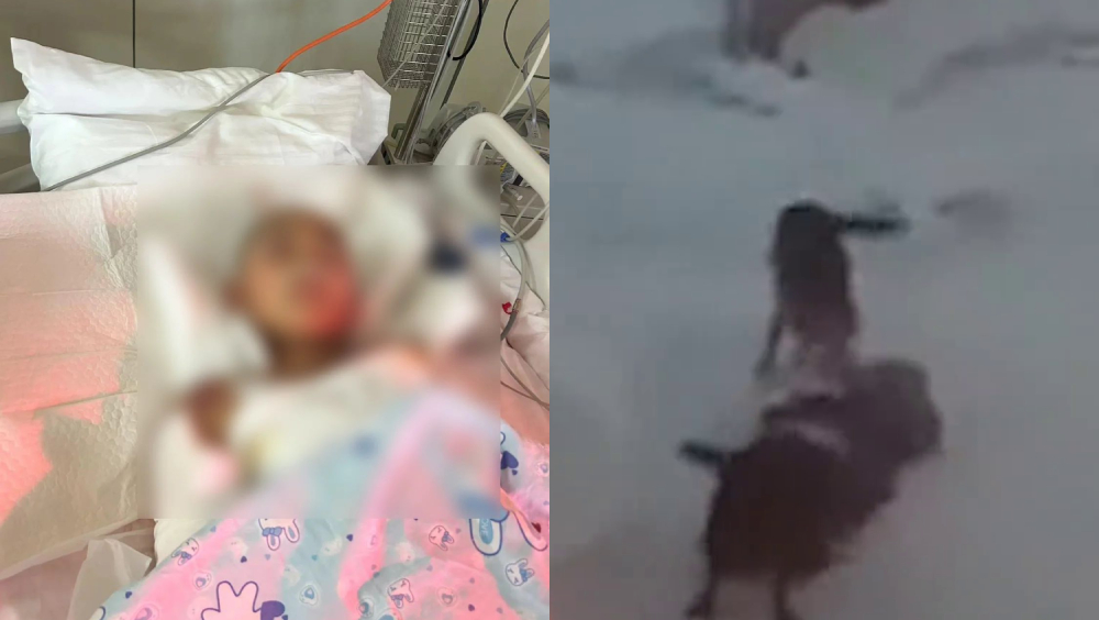 哈爾濱10歲男童遭兩惡犬咬成重傷，很大機會要截肢。