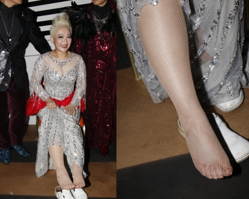 刘雅丽由4呎高台叉错脚跌落台底，右脚掌肿起。