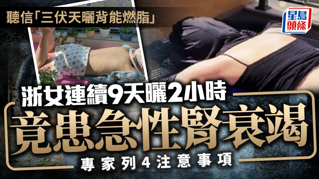 伏天曬背｜浙女曬背9天減肥不成 反致急性腎衰竭 哪些人不適合？