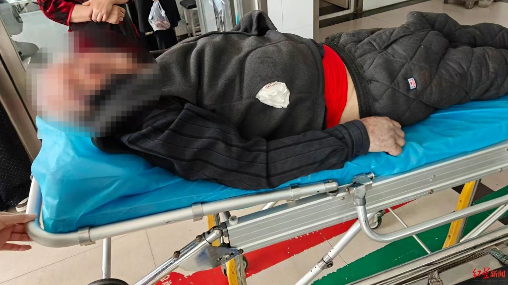 马女士父亲遭安老院室友狂殴两小时。红星新闻