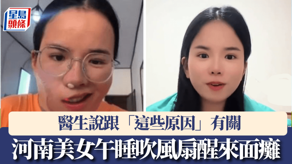  河南美女午睡吹風扇醒來嘴歪眼斜，確診「面癱」。