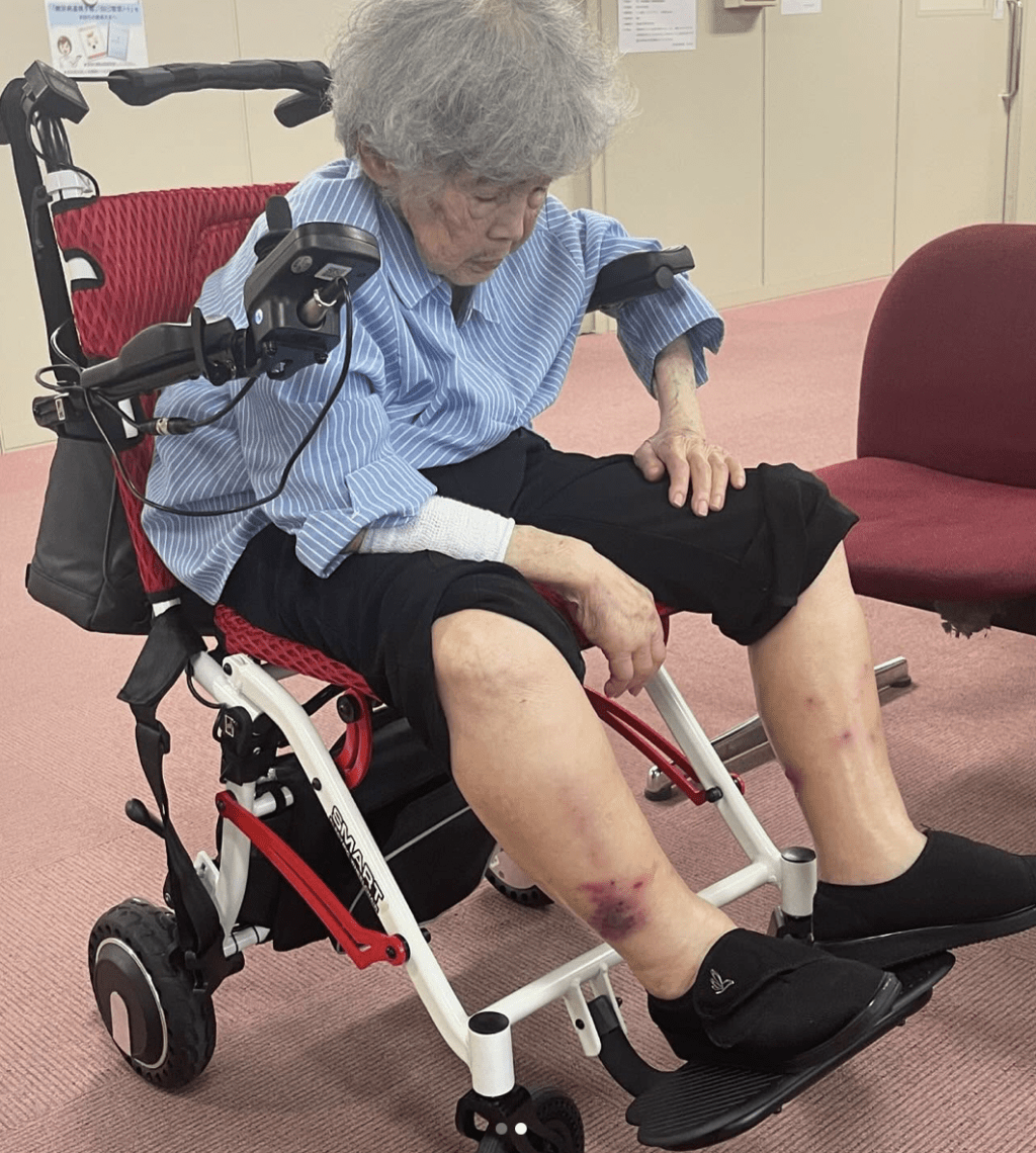 西本喜美子今年5月底因腳痛入院,兩週前剛度過了97歲生日,曾指腳痛已見好轉,「可以走路了」,希望明年可以去看櫻花,詎料昨日傳出死訊。 西本喜美子今年5月底因腳痛入院,兩週前剛度過了97歲生日,曾指腳痛已見好轉,「可以走路了」,希望明年可以去看櫻花,詎料昨日傳出死訊。