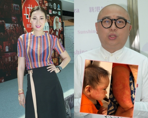 莊思敏特意到場支持；Bob就話囝囝用了太太自製的護膚膏已慢慢好轉。