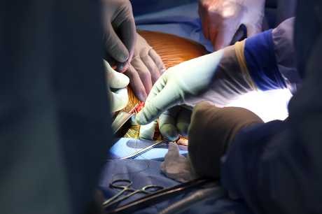 麻省總醫院醫生當日做移植手術。美聯社