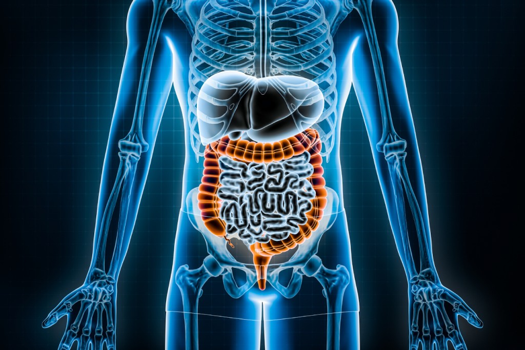 大肠瘜肉演变为大肠癌的风险甚高。（iStock图片）