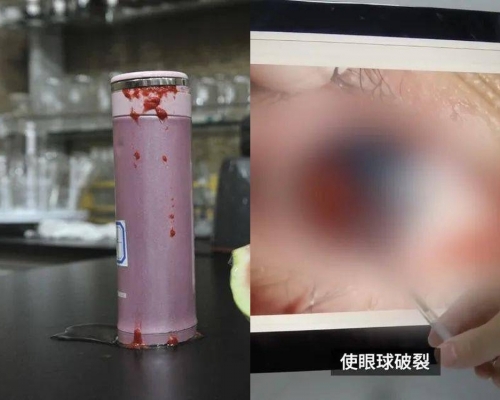 果汁及紅棗等比較適合真菌等繁殖，存放時間過長，可能產生氣體，使杯中氣壓增大，會造成「噴湧」。(網圖)