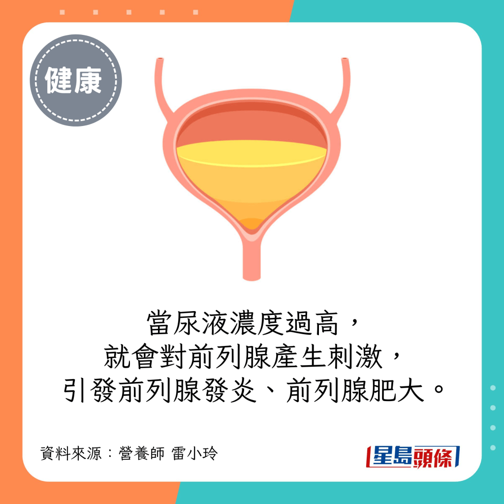 当尿液浓度过高，就会对前列腺产生刺激，引发前列腺发炎、前列腺肥大等症状。