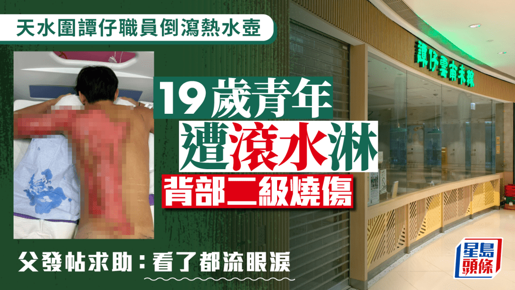 天水圍譚仔倒瀉熱水壺 19歲青年背部二級燒傷 譚仔：致深切歉意及慰問