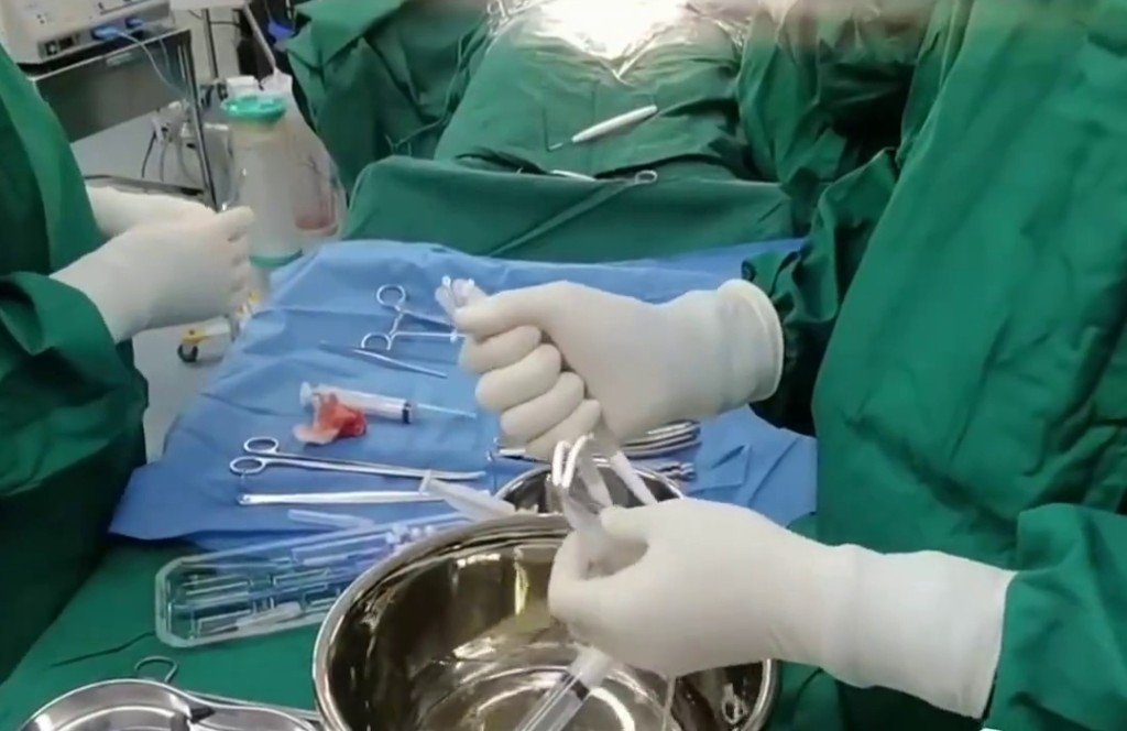 六旬漢植入17.5cm陰莖假體。 示意圖/微博