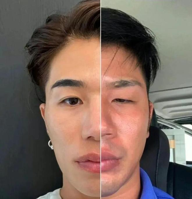 日丑男被骂“猪狒狒”饱受欺凌,狂操肌兼整容逆袭成“神户型男”。 日丑男被骂“猪狒狒”饱受欺凌,狂操肌兼整容逆袭成“神户型男”。