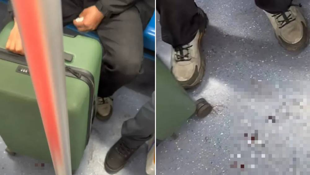 上海男坐地铁手提喼不停滴血，真相是……