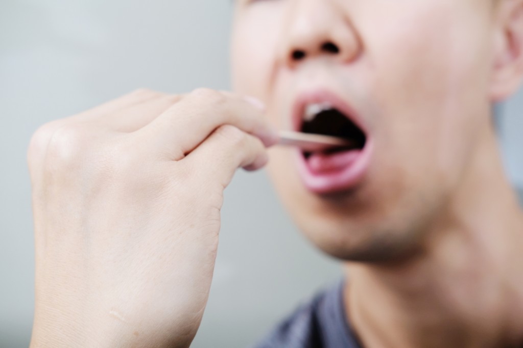 李先生多年來不時出現口腔潰瘍。iStock示意圖 李先生多年來不時出現口腔潰瘍。iStock示意圖