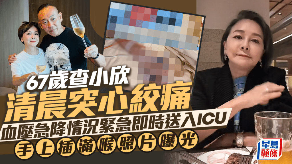 67歲查小欣清晨心絞痛血壓急降情況緊急即時送入ICU   手上插滿喉照片曝光