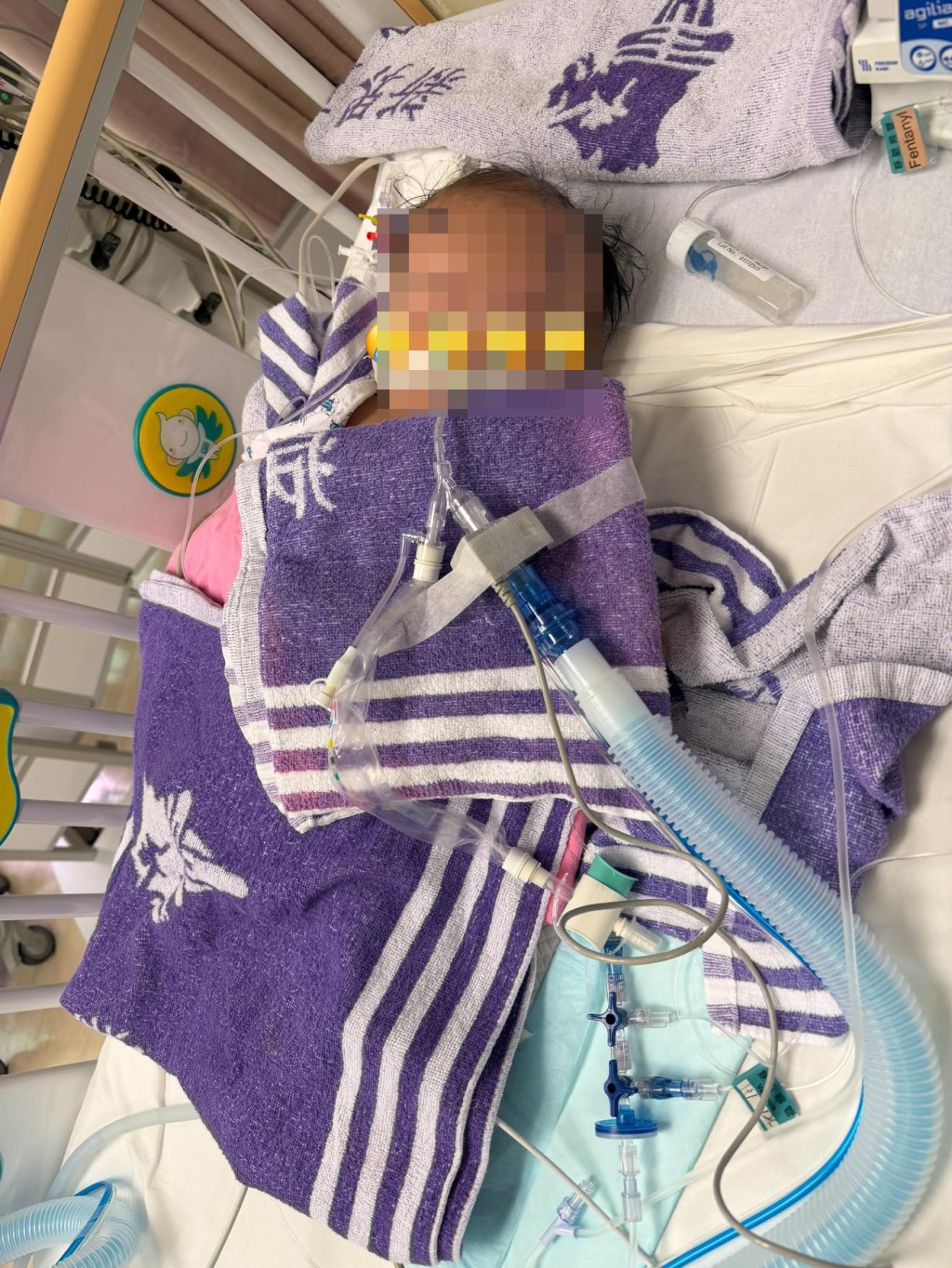 盧先生指兒子「細波」早前已接受手術，現時留醫兒童深切治療部。網上圖片