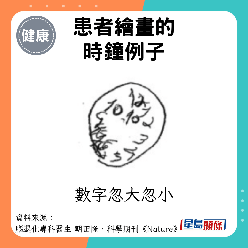 患者绘画的时钟例子：数字忽大忽小