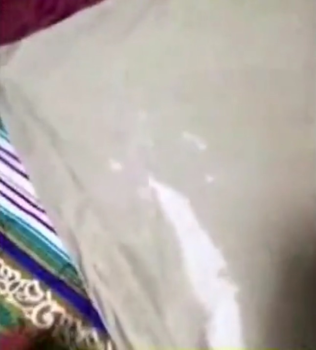 強力消毒粉溝水令幼童的衣服侵蝕到褪色。網上圖片