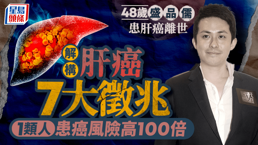 48歲盛品儒患肝癌離世 肝癌病情難察覺解構7大徵兆 1類人患癌風險高100倍