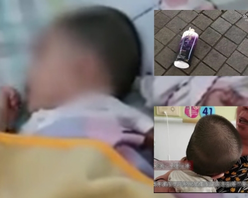 6個月大女嬰遭樓上洗頭水砸中,頭骨骨折未脫離危險期。影片截圖