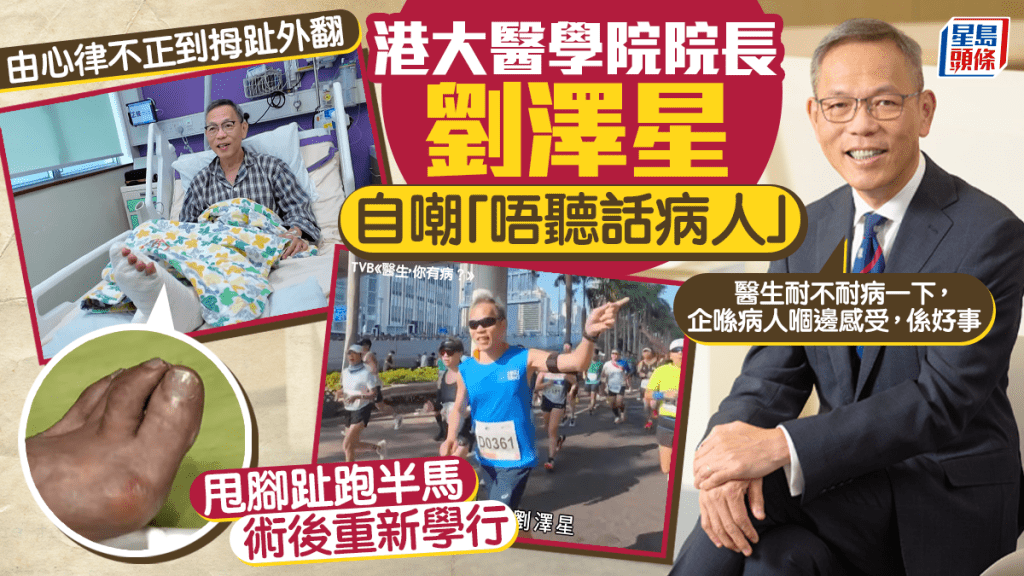 港大醫學院院長劉澤星自嘲「唔聽話病人」甩腳趾跑半馬 術後重新學行