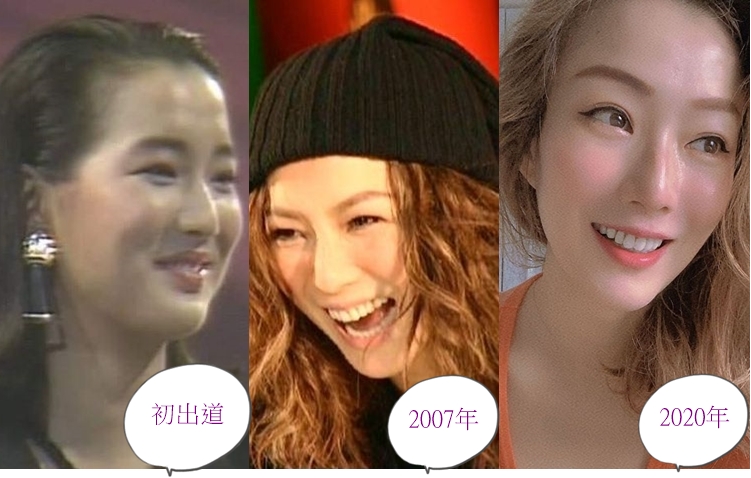 鄭秀文棚牙愈嚟愈靚。