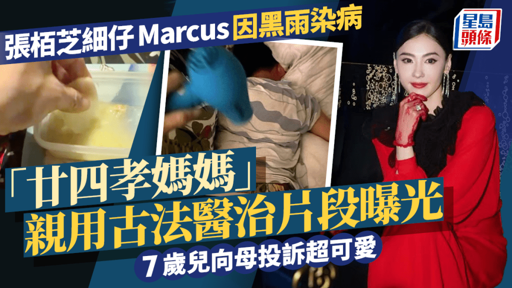 張栢芝細仔Marcus因黑雨染病  「廿四孝媽媽」親用古法醫治片段曝光  7歲兒向母投訴超可愛