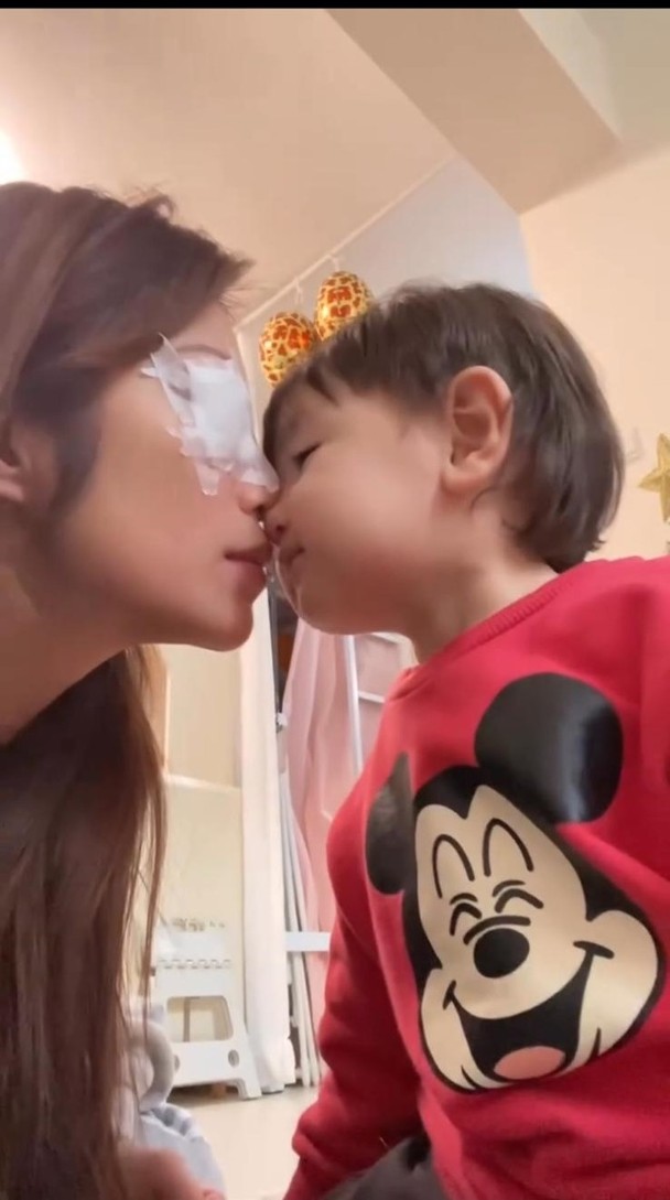 楊梓菁去年7月受免系統攻擊甲狀腺導致失眠、暴瘦和眼凸大細眼，有阿仔Jace錫錫。